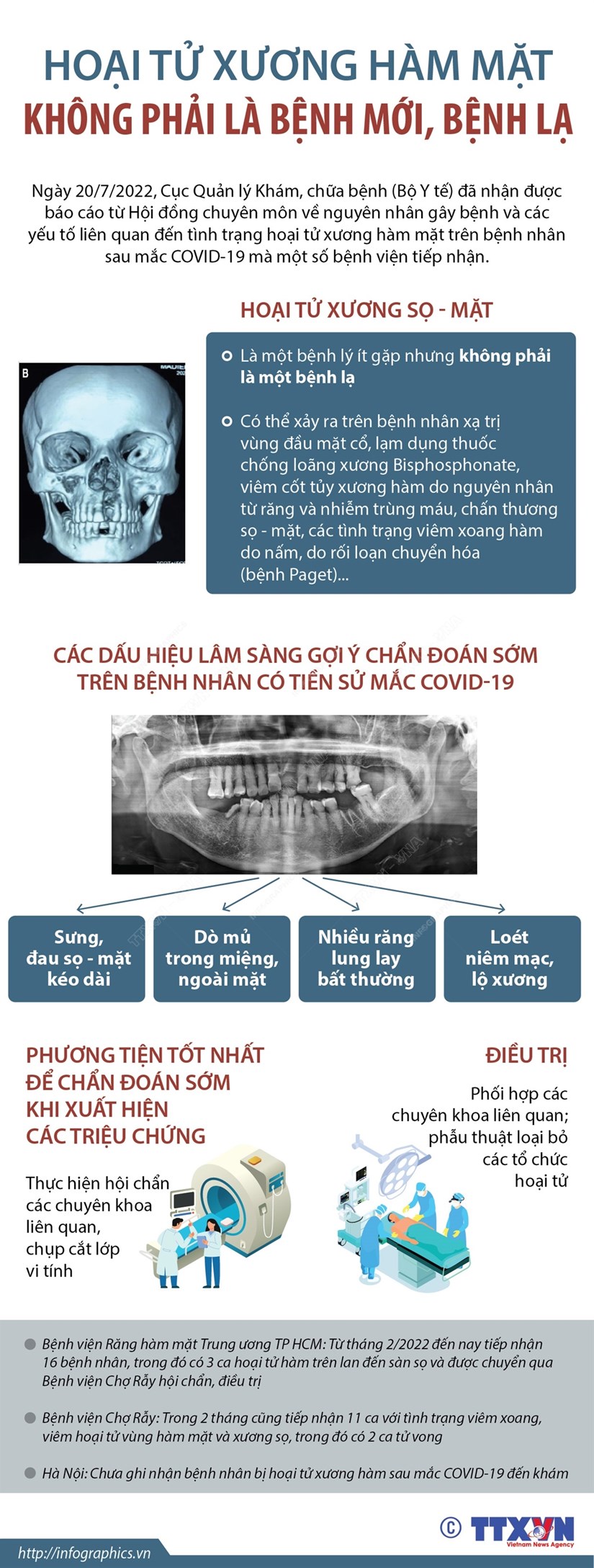 [Infographics] Kết luận về tình trạng hoại tử xương hàm mặt