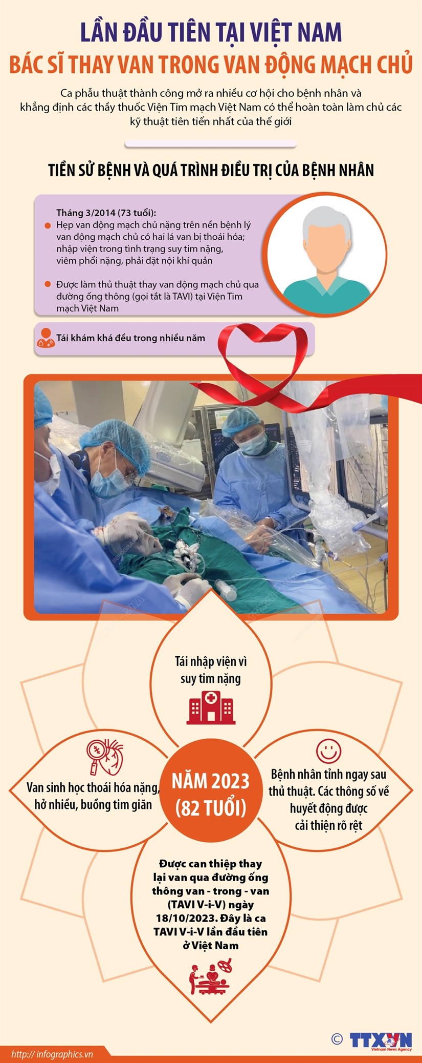 [Infographic] Thực hiện ca thay van trong van động mạch chủ lần đầu tiên ở Việt Nam