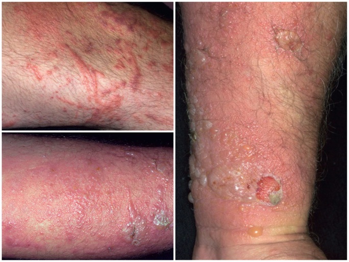 Cảnh báo mới về sự nguy hiểm của kiến ba khoang