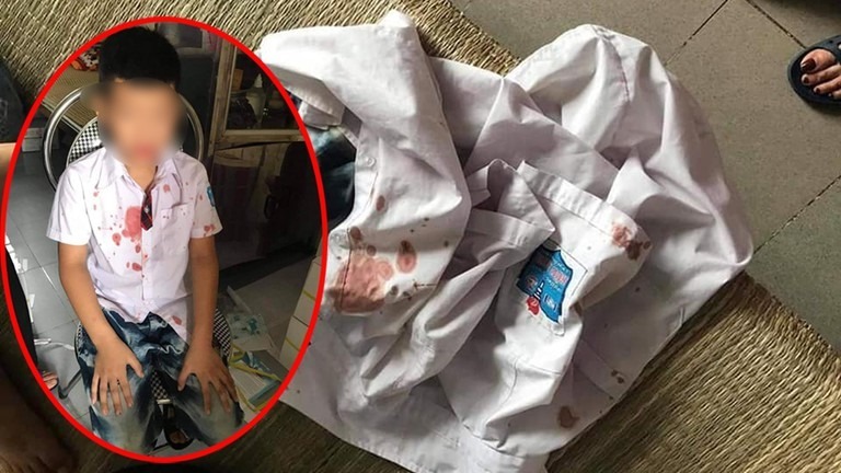 Ngăn chặn hành vi bạo lực - Bắt đầu từ sự làm gương của người lớn