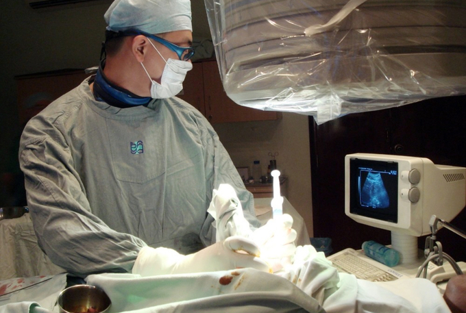 5 phương pháp điều trị ung thư gan không cần mổ