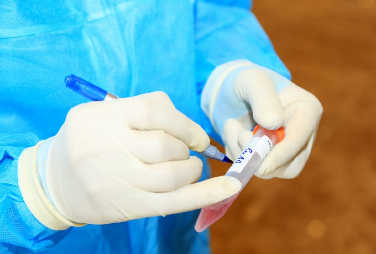 Hà Nam ghi nhận hơn 900 ca F0 trong ngày 28/02