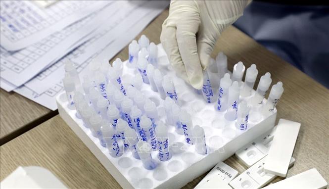 Từ ngày 15/5, tạm dừng yêu cầu xét nghiệm SARS-CoV-2 khi nhập cảnh Việt Nam