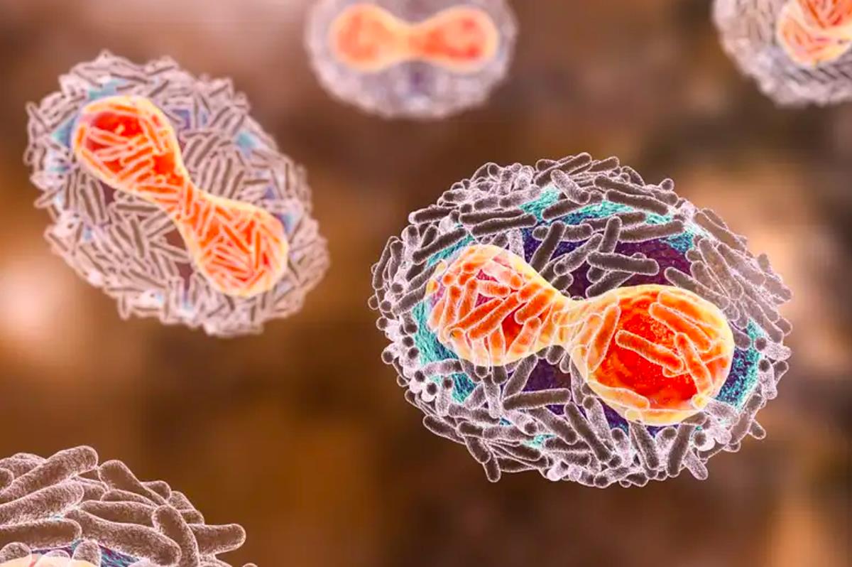 Triệu chứng mới của bệnh đậu mùa khỉ