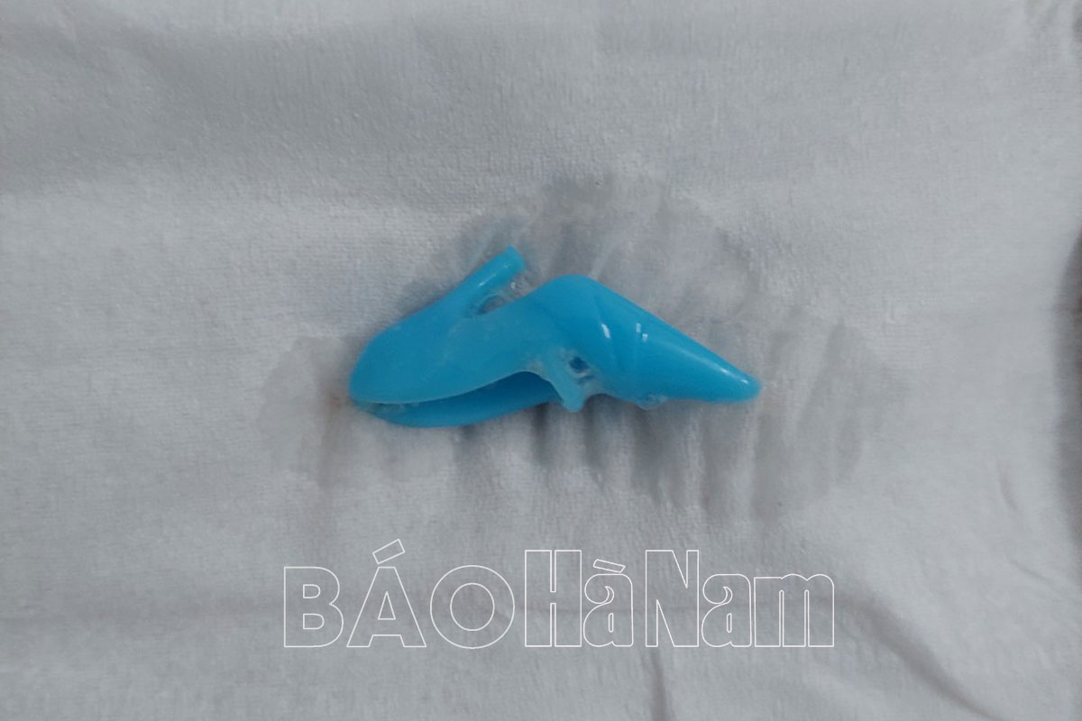 Nuốt chiếc giày búp bê đồ chơi, một trẻ 4 tháng tuổi ở xã Tiêu Động suýt nguy hiểm tính mạng