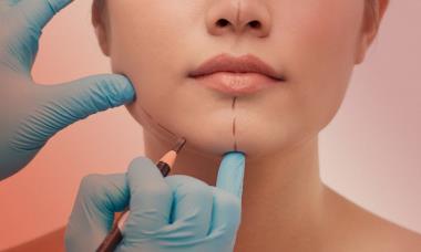 Phẫu thuật thẩm mỹ đến mức nào sẽ phải làm lại thẻ căn cước, hộ chiếu?