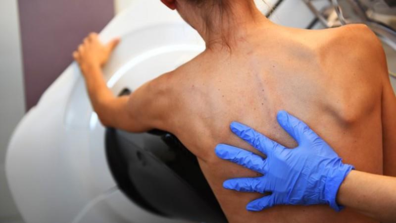 Phát hiện mới mở ra triển vọng trong điều trị bệnh ung thư vú