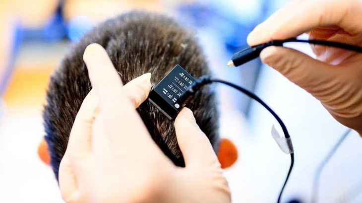 Thiết bị biến suy nghĩ thành giọng nói gần như tức thì