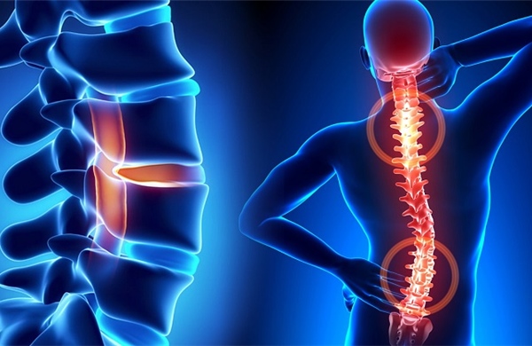 Điều trị chấn thương tủy sống bằng tế bào gốc