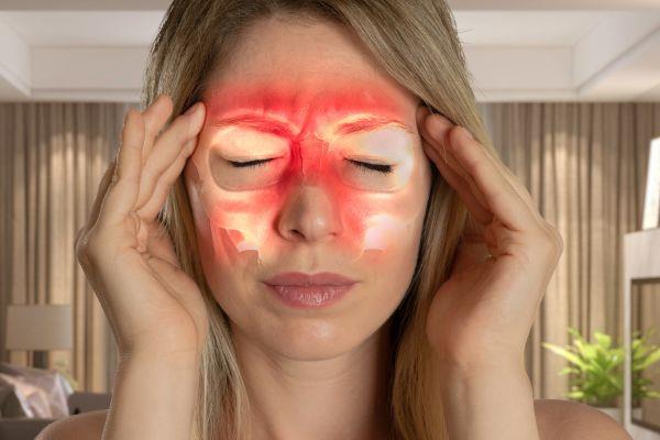 Dị ứng và đau đầu do xoang