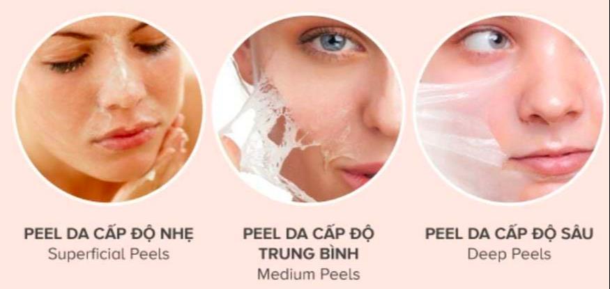 Ưu điểm và rủi ro khi peel da