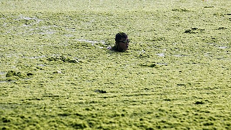 Phát hiện virus khiến con người bị ngớ ngẩn