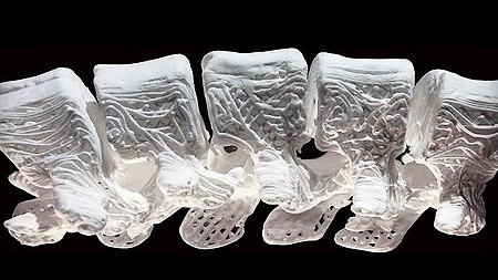 Sử dụng vật liệu sinh học có độ đàn hồi cao để tái tạo xương