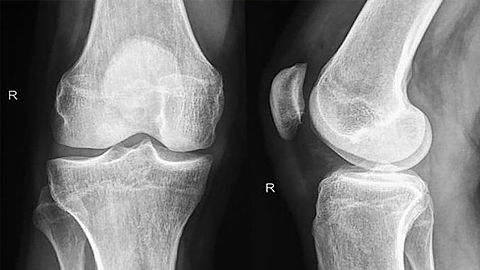 Đột phá công nghệ tế bào giúp tự tái tạo các bộ phận trên cơ thể người