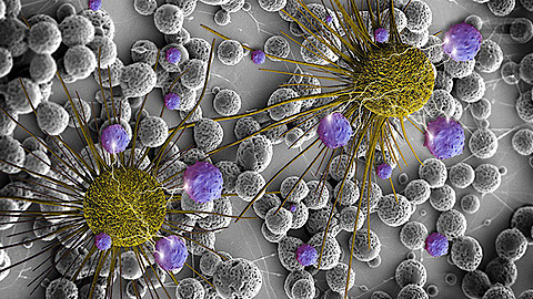 Các nhà khoa học Siberia phát triển một công nghệ mới để điều trị ung thư