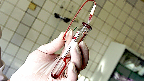 Thiết bị phát hiện vi khuẩn trong cơ thể chỉ trong ít phút