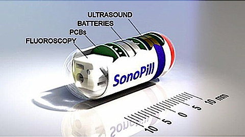 Viên nang robot phát hiện ung thư ruột thay cho nội soi