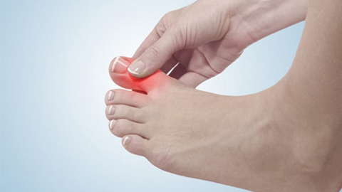 Cách kiểm soát bệnh gút, ngăn ngừa biến chứng an toàn, hiệu quả