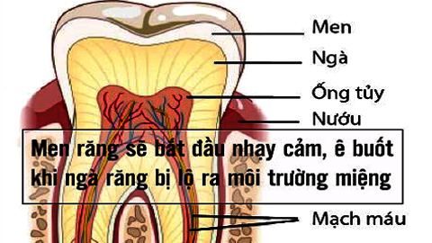 Cuộc chiến chống răng ê buốt