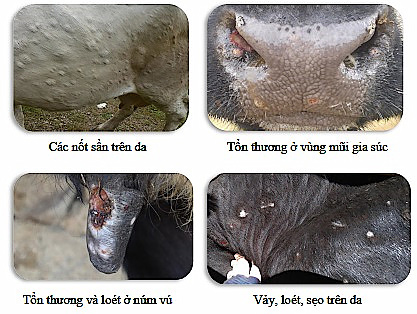 Một số đặc điểm của bệnh viêm da nổi cục