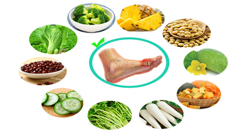 8 cách giảm axit uric không dùng thuốc