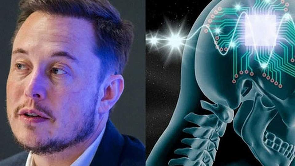 Công ty của Elon Musk chuẩn bị cấy ghép chip vào não người để "chế tạo" siêu nhân